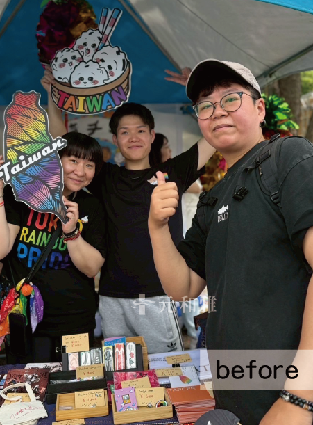 天鵝頸術前照片元和雅毛毛天鵝頸手術術後案例 天鵝頸術前照片元和雅毛毛天鵝頸手術術後案例