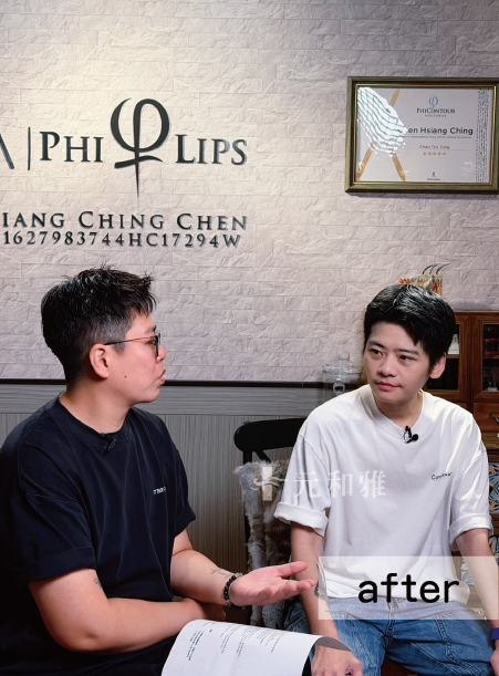 天鵝頸術後照片元和雅毛毛天鵝頸手術術後案例 天鵝頸術後照片元和雅毛毛天鵝頸手術術後案例