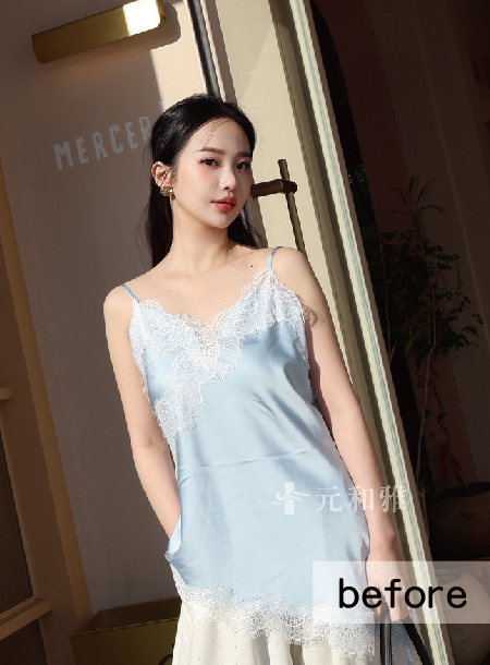 綠茶隆乳術前照 綠茶隆乳術前照