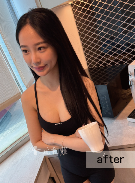 綠妹魔滴2.0隆乳術後穿搭紀錄 綠妹魔滴2.0隆乳術後穿搭紀錄