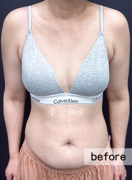 ALL_catalog_25L10_925Pbe2vW4