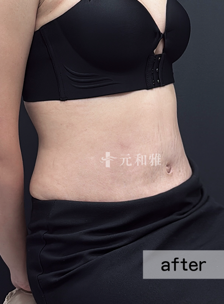 ALL_catalog_25L11_AYsCjb1T5h