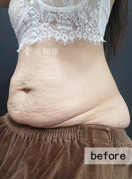 ALL_catalog_25L11_n3DJ9IIJ8j