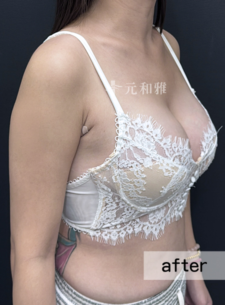 ALL_catalog_25L22_75IBMEfoKF