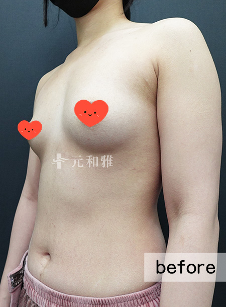 ALL_catalog_26C06_eNqzvGbCHS