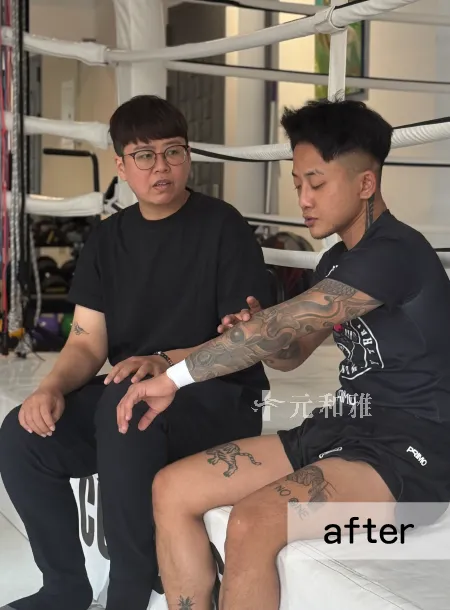 高雄平胸手術術後案例毛毛顧問 高雄平胸手術術後案例毛毛顧問