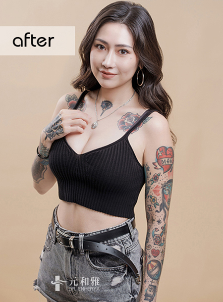 Different body rib nose augmentation + pearl wave breast augmentation: Creating a mixed-race magical beauty, the double upgrade secrets of a female tattoo artist.