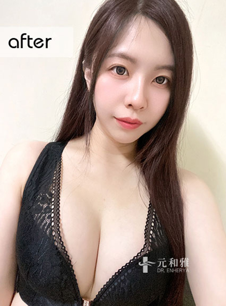 Magic Drop Second Generation Breast Augmentation JOY 2.0 creates a nuclear bomb level beautiful chest, sweet live streamer explodes with a career line!