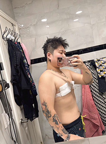 I flew from overseas to Taiwan for breast reduction surgery, just to run more comfortably and eat a lot of braised pork rice.