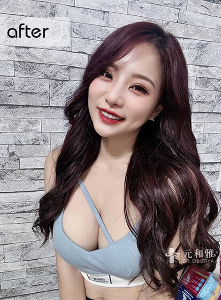 Will I regret breast augmentation? A friend's words woke me up! At Enherya, I found back the "full confidence" with the perfect curves through magic drops.