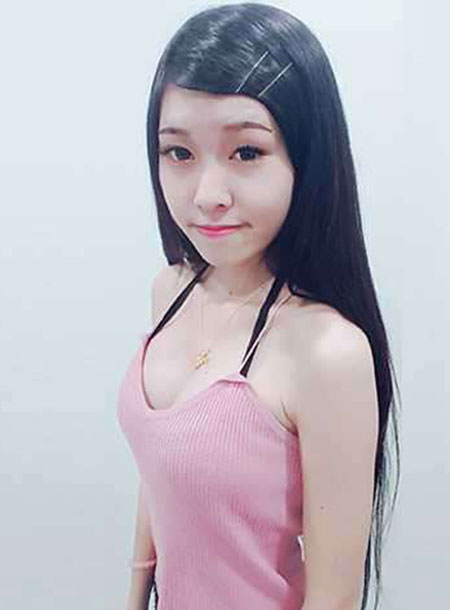 Breast augmentation expert water drop shaped silicone breast augmentation Taiwan reputation recommended case photos
