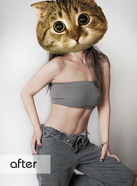 Abdominal curve reconstruction, regain your dream waistline.