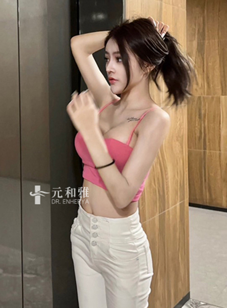 Half rib nose augmentation, double eyelid surgery, and queen wave breast augmentation surgery, the last mile from being white and thin to beautiful.