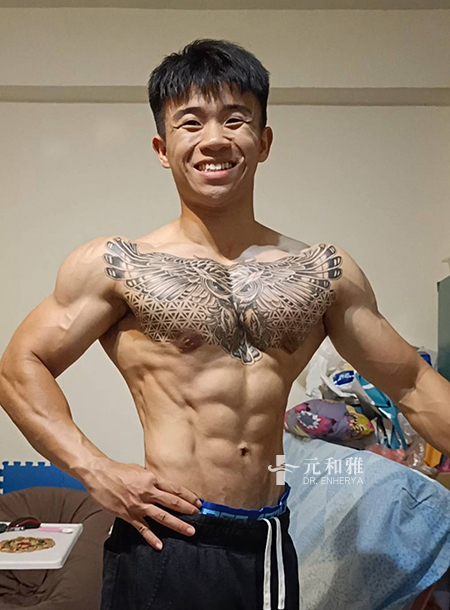 Breast reduction surgery combined with fitness transformation: from muscle definition to soul alignment, I found my true self again.