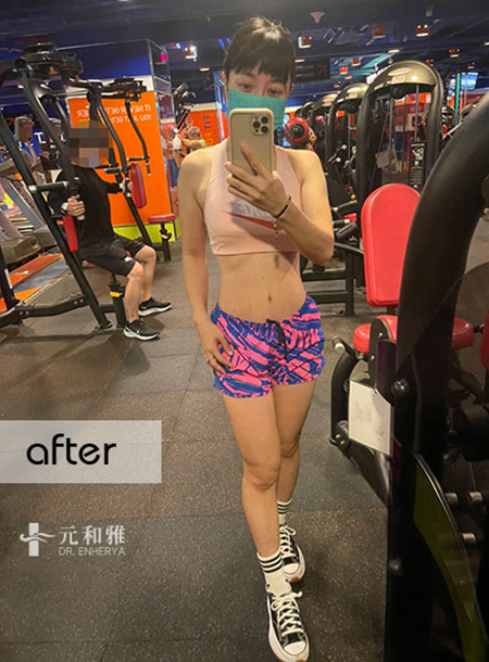 Tainan Abdominal Tightening Recommendations: Real Improvement Stories from Three Postpartum Moms, The Key to Restoring a Flat Abdomen