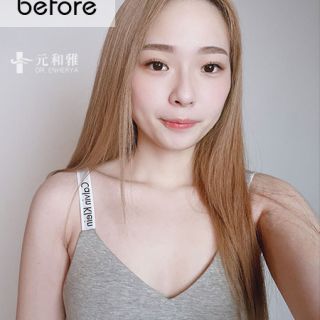 台南女王波隆乳診所