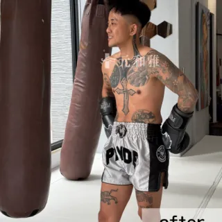 170-1高雄平胸手術70