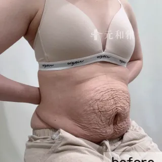 1_000