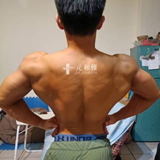 平胸術後訓練, 平胸肌肉線條