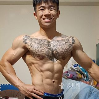 平胸手術, 平胸案例分享, 平胸健身