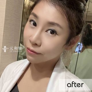 天鵝頸拉提
