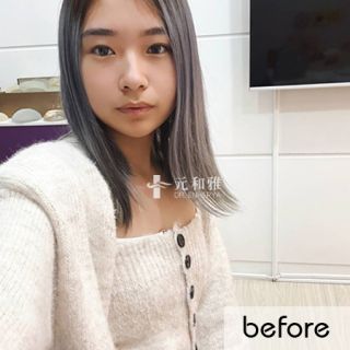 女王波適合對象, 隆乳經驗談