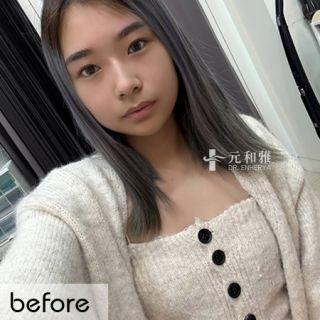 女王波適合對象, 隆乳經驗談