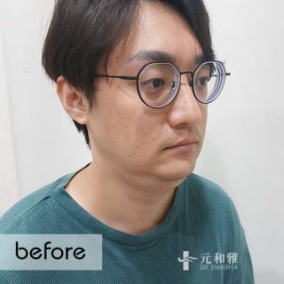 天鵝頸拉提案例