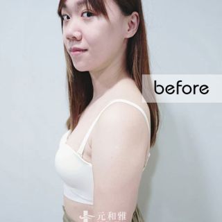 魔滴2.0隆乳