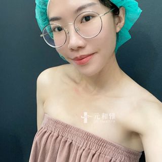 珍珠波隆乳術前