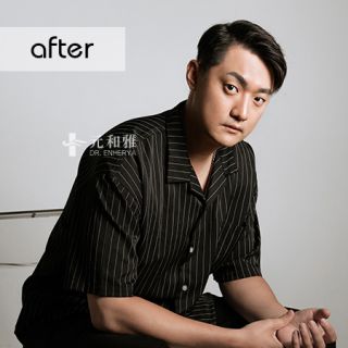 天鵝頸拉提術後