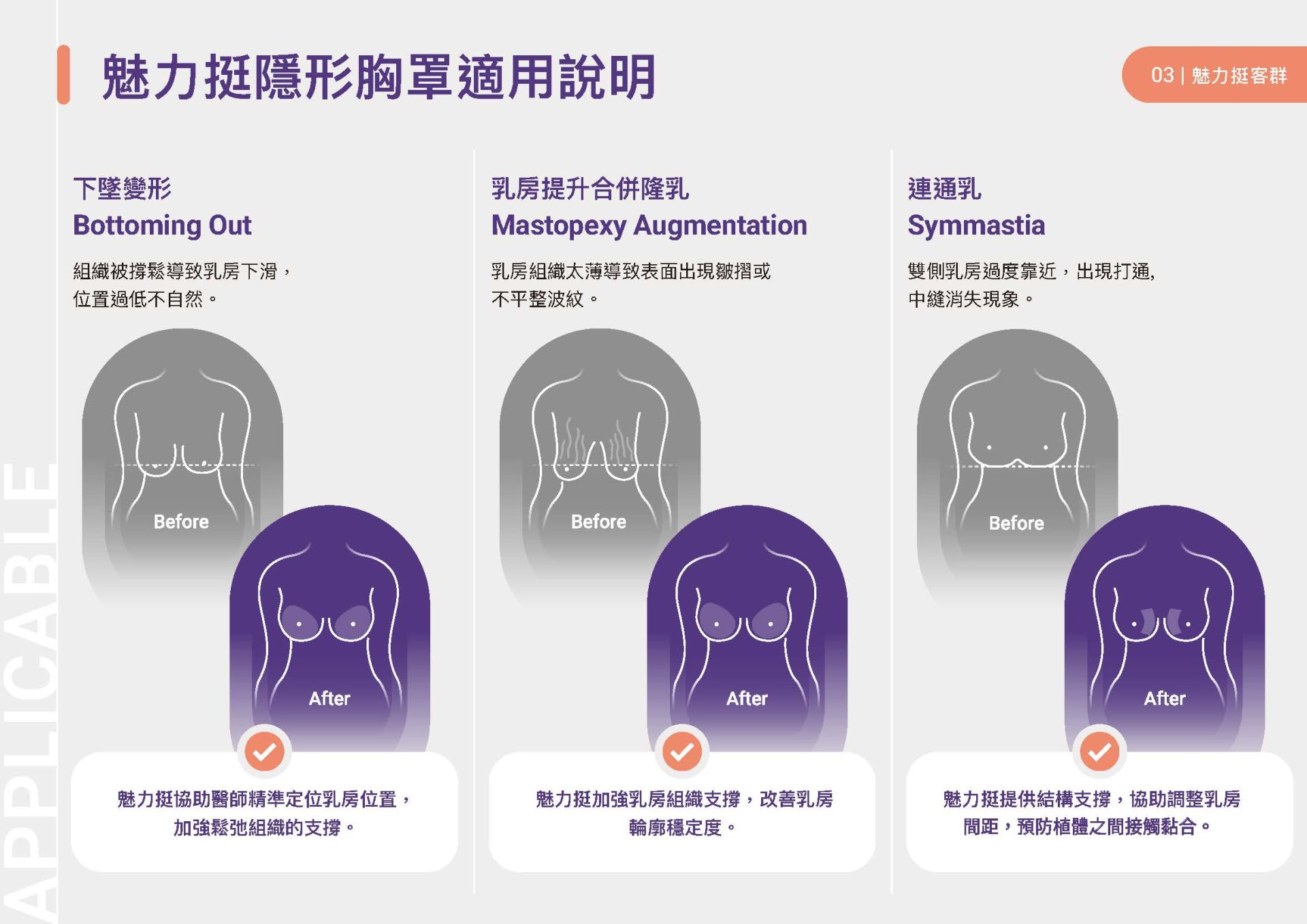 魅力挺GalaFLEX隱形內衣