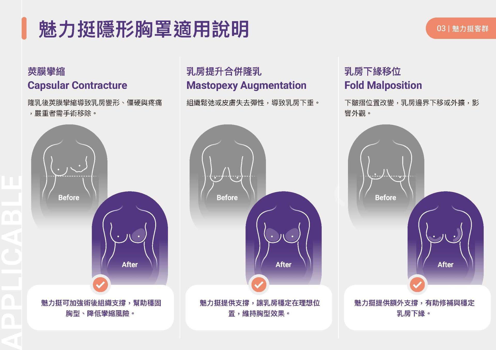 魅力挺GalaFLEX隱形內衣