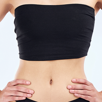 產後腹直肌分離+妊娠紋很困擾?腹部拉皮能一次改善嗎?