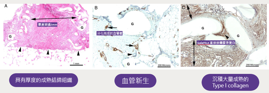 GalaFLEX大孔網隙提供生長支架