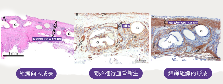 GalaFLEX大孔網隙提供生長支架