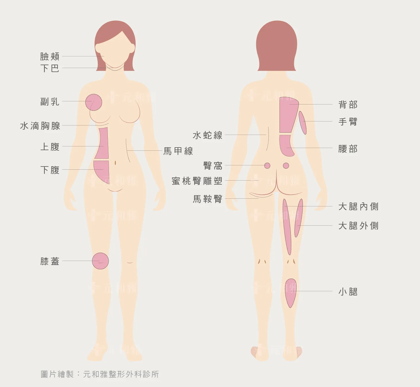 二代威塑抽脂VASER 2.2